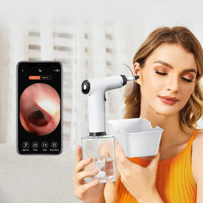 GentEar™ - Ear Wax Remover