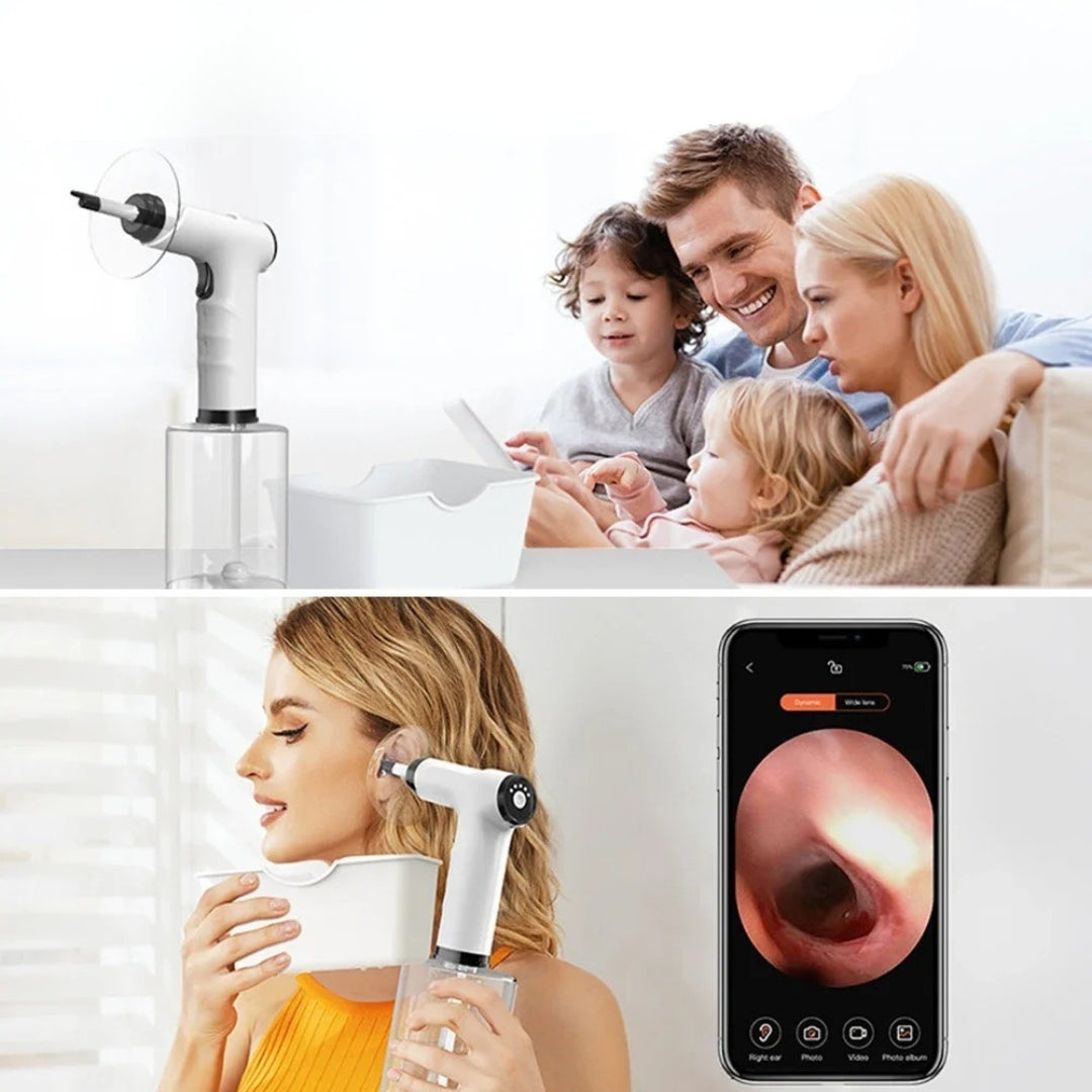 GentEar™ - Ear Wax Remover