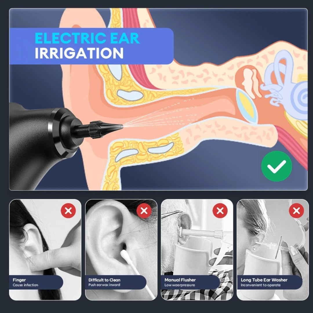 SafeSpree™ - Ear Wax Remover