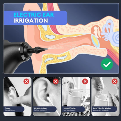SafeSpree™ - Ear Wax Remover