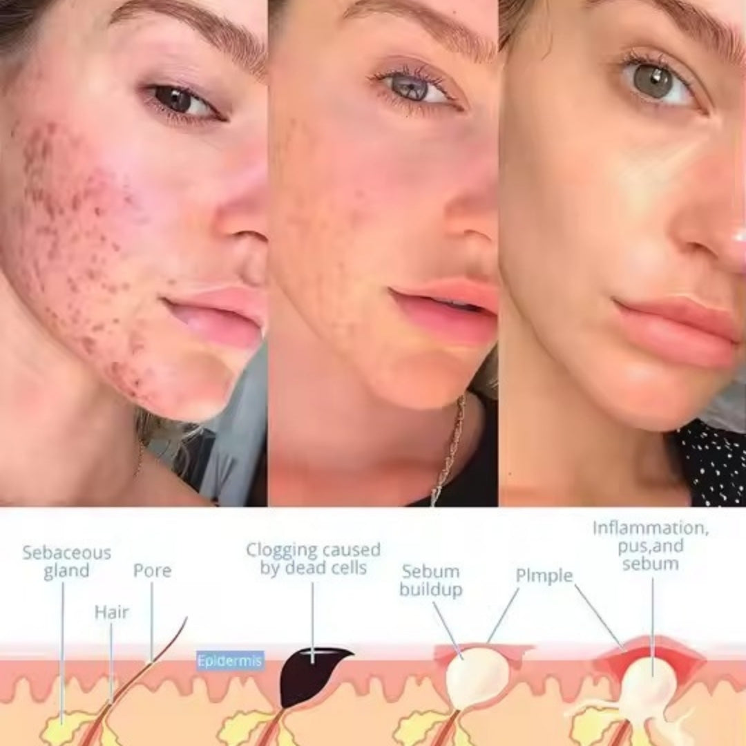 Velvra™ - Facial Wand