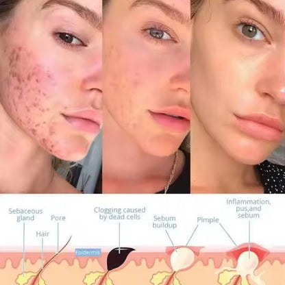 Velvra™ - Facial Wand